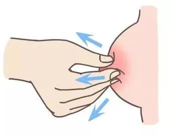 大乳头、小乳头、扁平乳头、凹陷乳头3大喂养指导及护理指南！