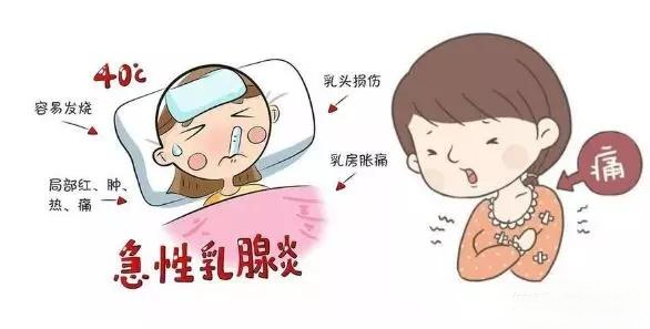 回奶乳腺炎，怎么办？