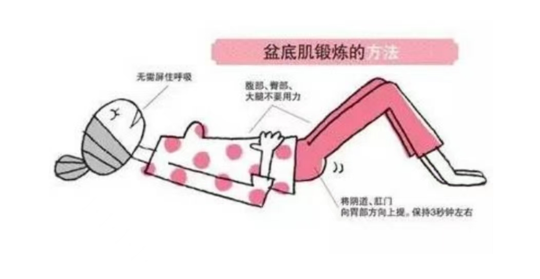 产后如何自己进行盆底肌训练