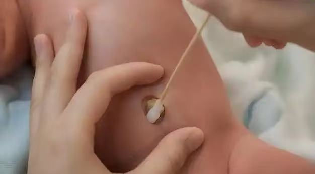  肚脐眼里的污垢，到底能不能抠？ 