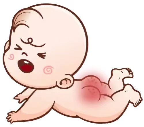 预防宝宝红屁股四大实用技巧  