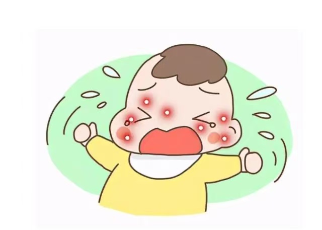 孩子湿疹反复发作怎么办？这些防治方法请收好！